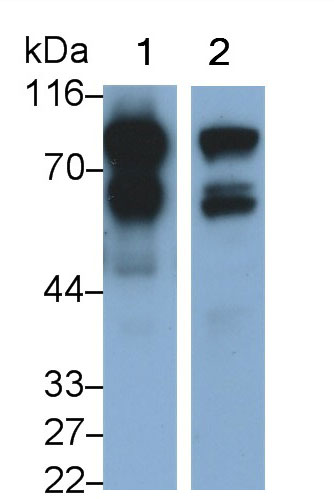 Monoclonal Antibody to Nexilin (NEXN)