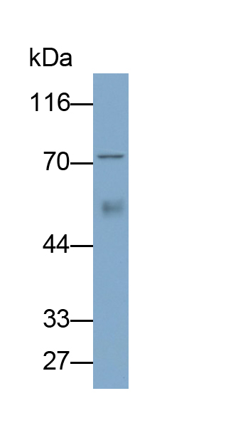 Monoclonal Antibody to Mesothelin (MSLN)