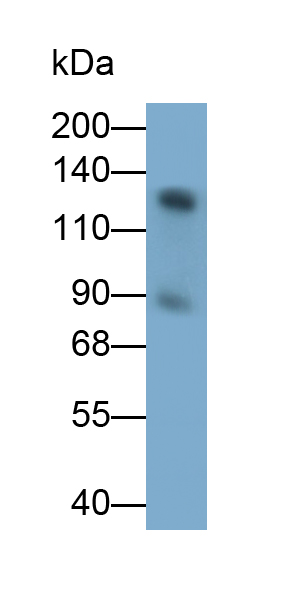 Monoclonal Antibody to Inter Alpha-Globulin Inhibitor H4 (ITIH4)