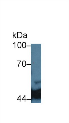 Monoclonal Antibody to Isocitrate Dehydrogenase 1, Soluble (IDH1)