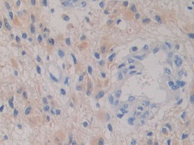 Monoclonal Antibody to Isocitrate Dehydrogenase 1, Soluble (IDH1)