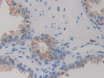 Monoclonal Antibody to Isocitrate Dehydrogenase 1, Soluble (IDH1)