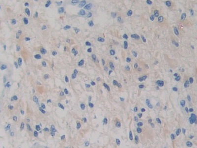 Monoclonal Antibody to Isocitrate Dehydrogenase 1, Soluble (IDH1)