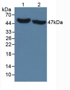 Monoclonal Antibody to Isocitrate Dehydrogenase 1, Soluble (IDH1)