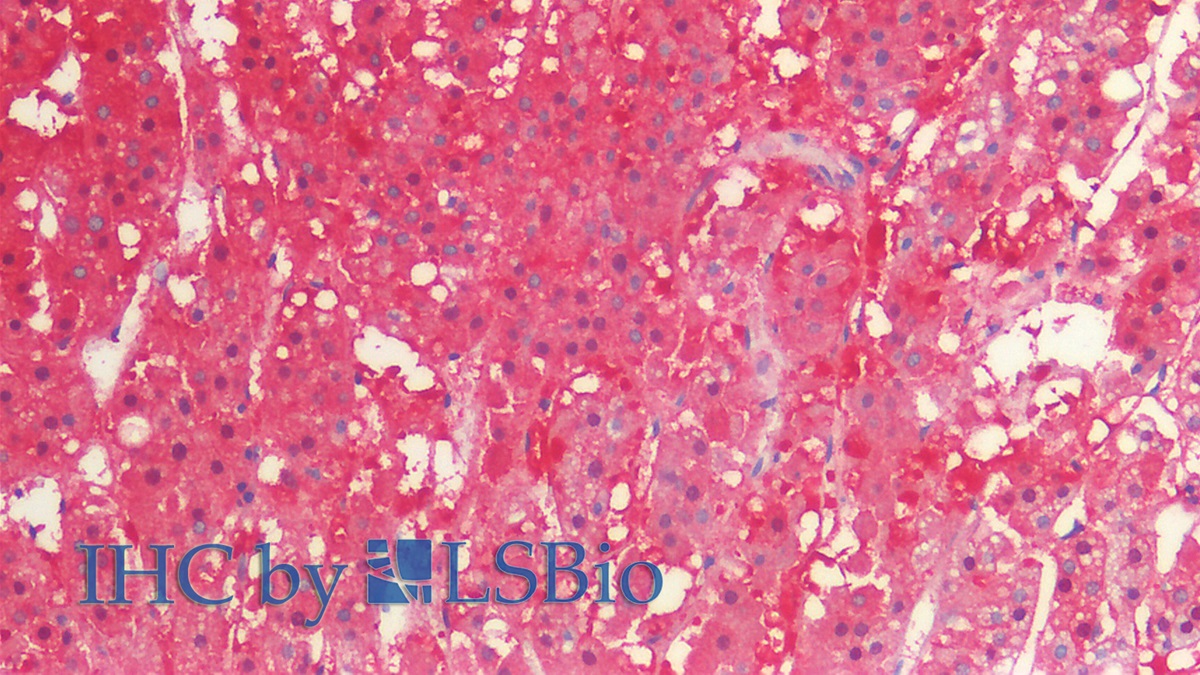 Monoclonal Antibody to Isocitrate Dehydrogenase 1, Soluble (IDH1)