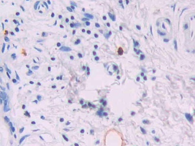 Monoclonal Antibody to Isocitrate Dehydrogenase 1, Soluble (IDH1)