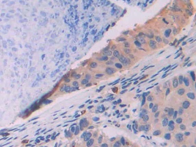 Monoclonal Antibody to Isocitrate Dehydrogenase 1, Soluble (IDH1)