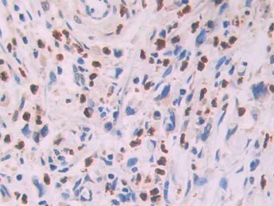 Monoclonal Antibody to Isocitrate Dehydrogenase 1, Soluble (IDH1)