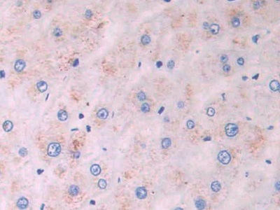 Monoclonal Antibody to Isocitrate Dehydrogenase 1, Soluble (IDH1)