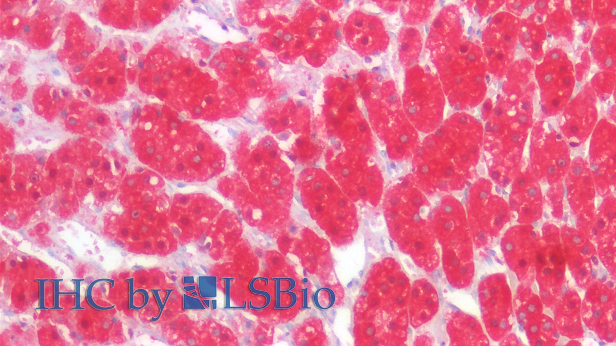 Monoclonal Antibody to Isocitrate Dehydrogenase 1, Soluble (IDH1)