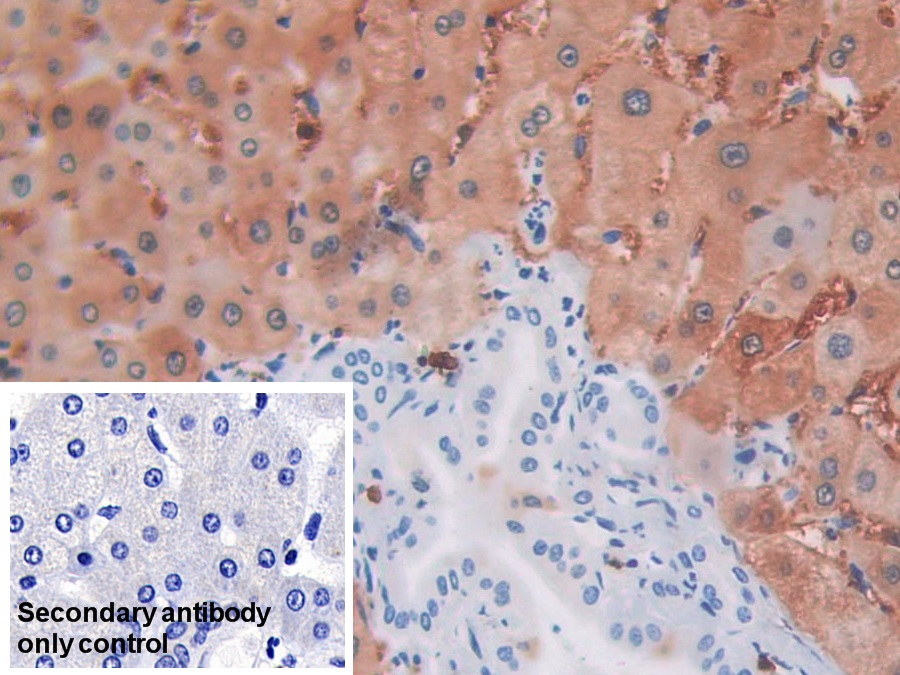 Monoclonal Antibody to Isocitrate Dehydrogenase 1, Soluble (IDH1)