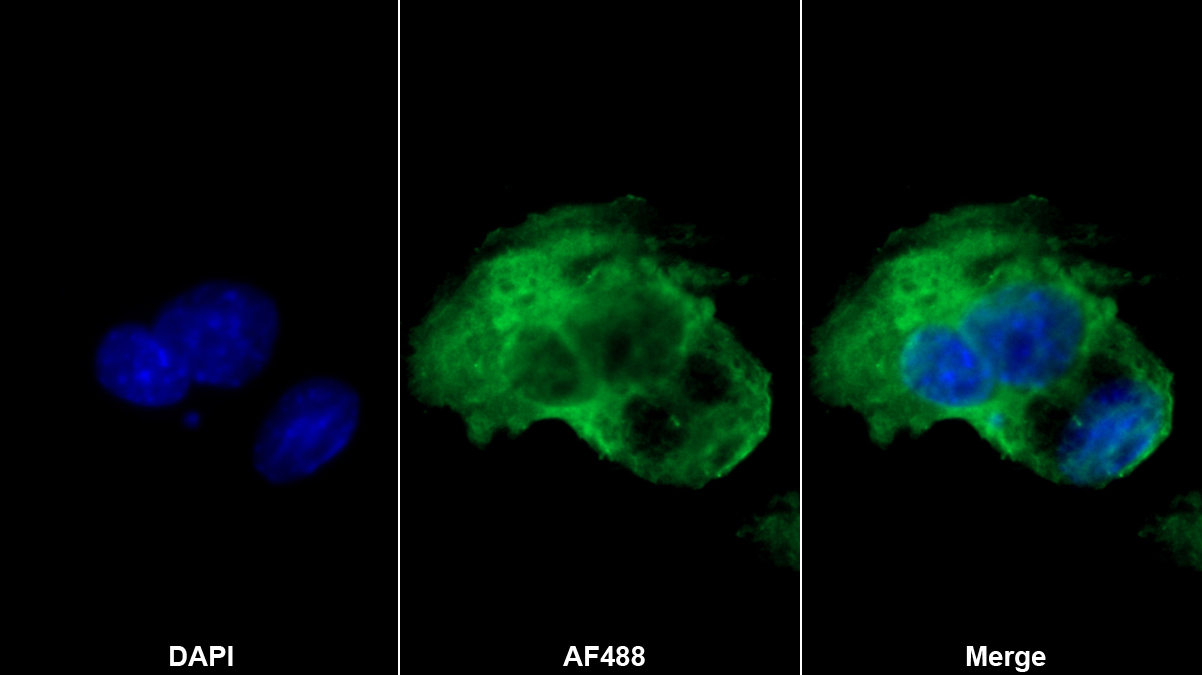 Monoclonal Antibody to Biglycan (BGN)