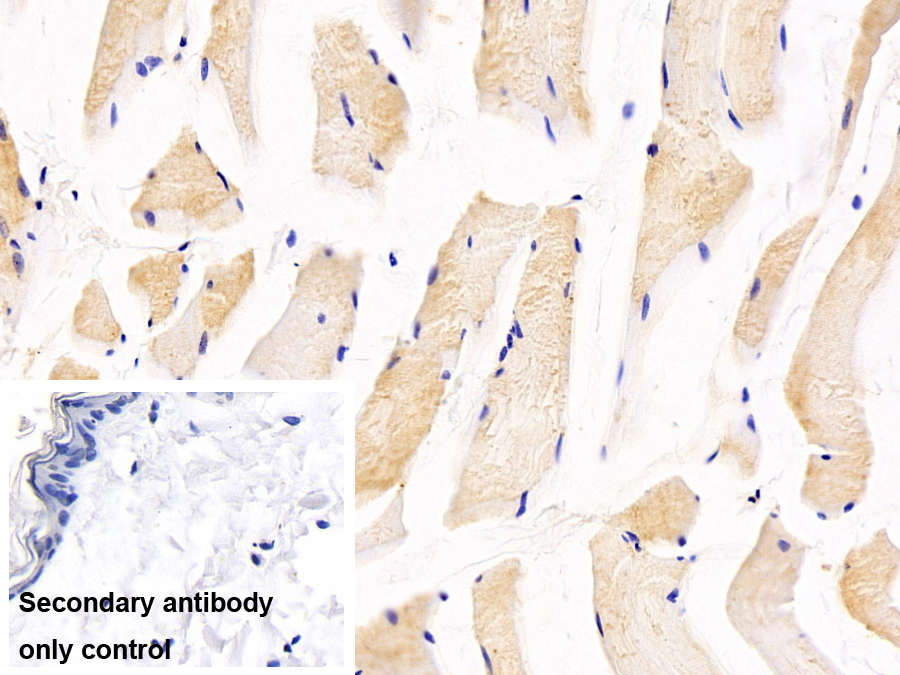 Monoclonal Antibody to Cystatin 6 (CST6)