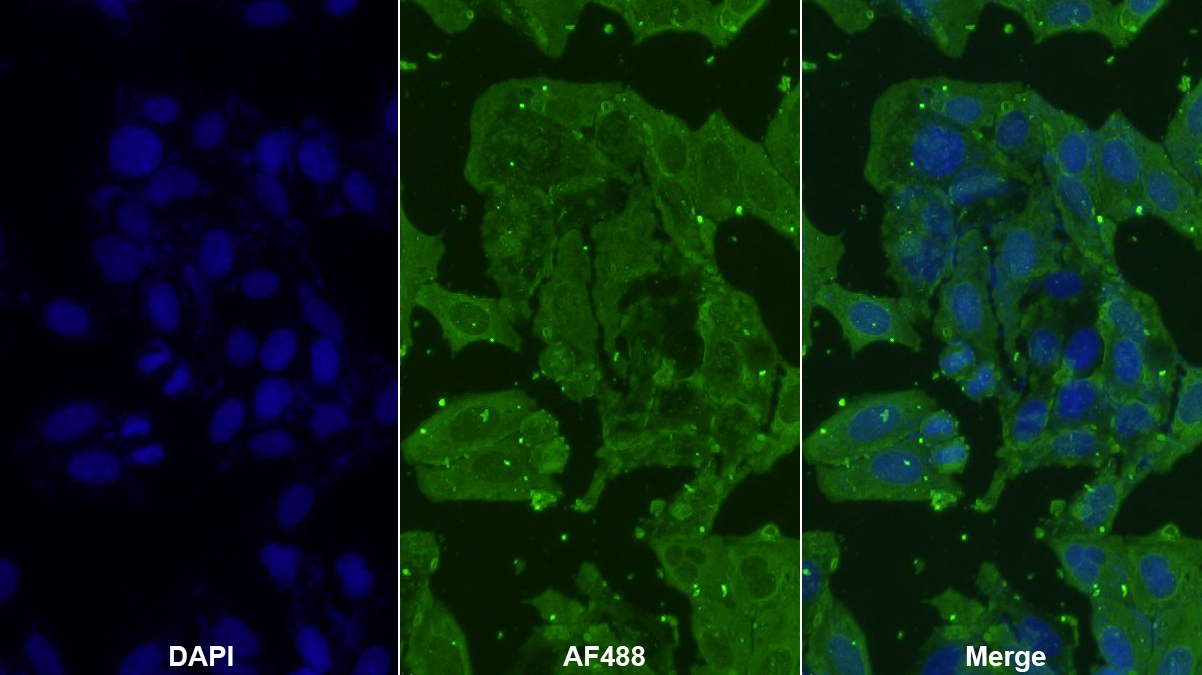 Monoclonal Antibody to Casein Kappa (CSN3)