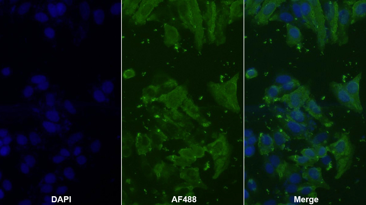 Monoclonal Antibody to Casein Kappa (CSN3)