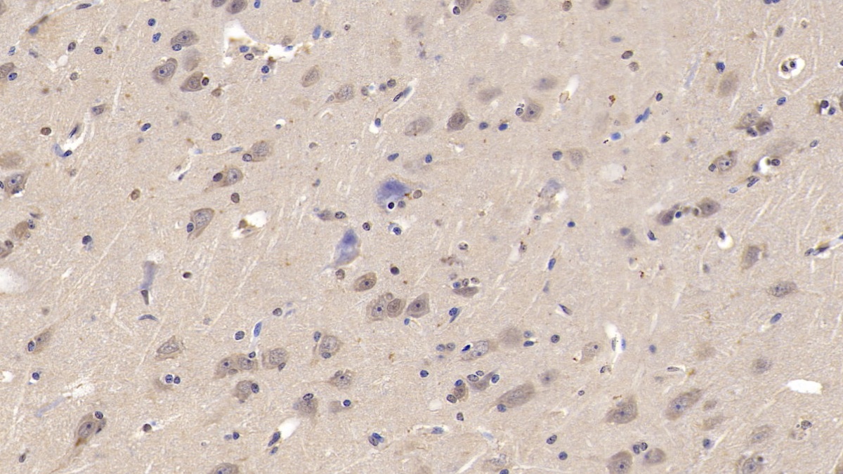 Monoclonal Antibody to Lecithin Cholesterol Acyltransferase (LCAT)