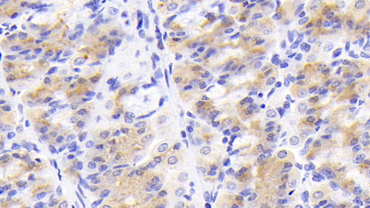 Monoclonal Antibody to Beclin 1 (BECN1)