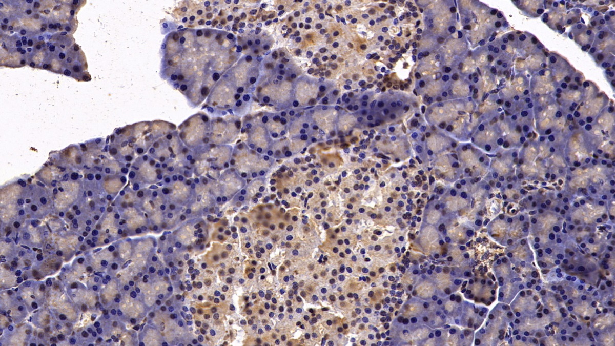 Monoclonal Antibody to Von Hippel Lindau Tumor Suppressor (vHL)