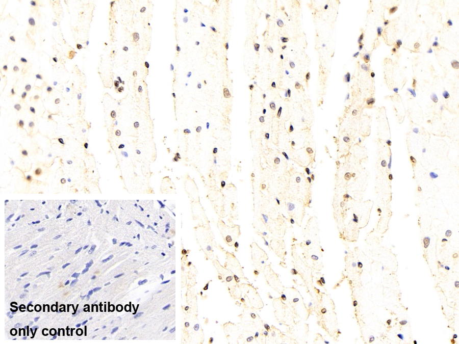 Monoclonal Antibody to Snail Homolog 1 (SNAI1)