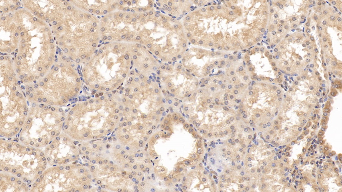 Monoclonal Antibody to RAB5A, Member RAS Oncogene Family (RAB5A)