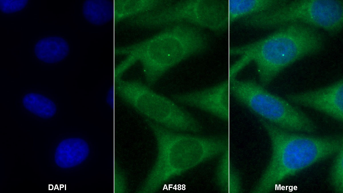 Monoclonal Antibody to Alpha-2-Glycoprotein 1, Zinc Binding (aZGP1)