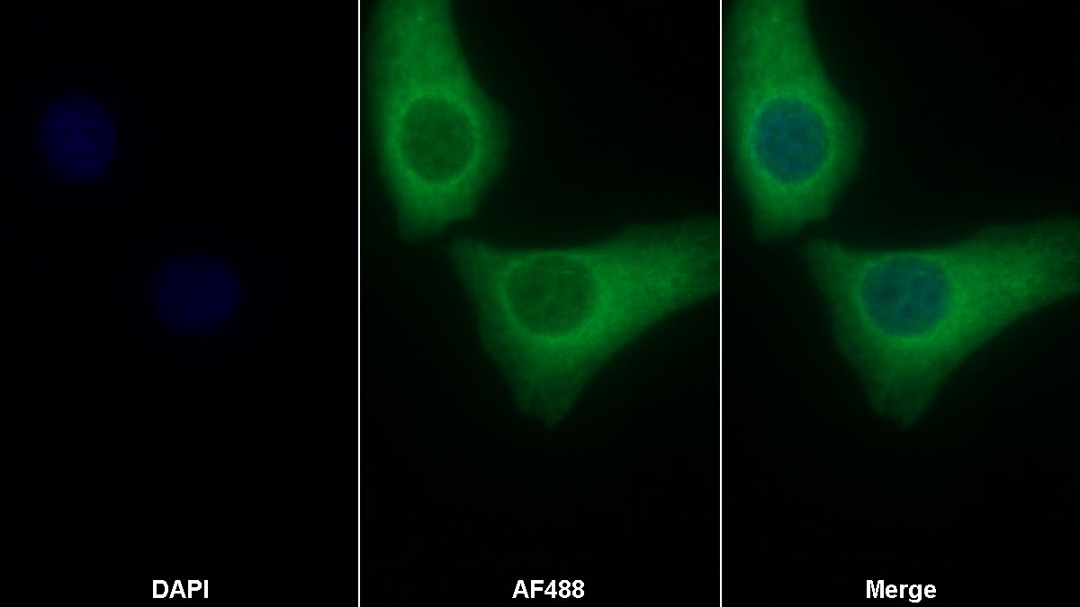 Monoclonal Antibody to Interleukin 1 Family, Member 9 (IL1F9)