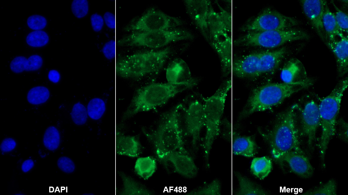Monoclonal Antibody to Ubiquitin Cross Reactive Protein (UCRP)
