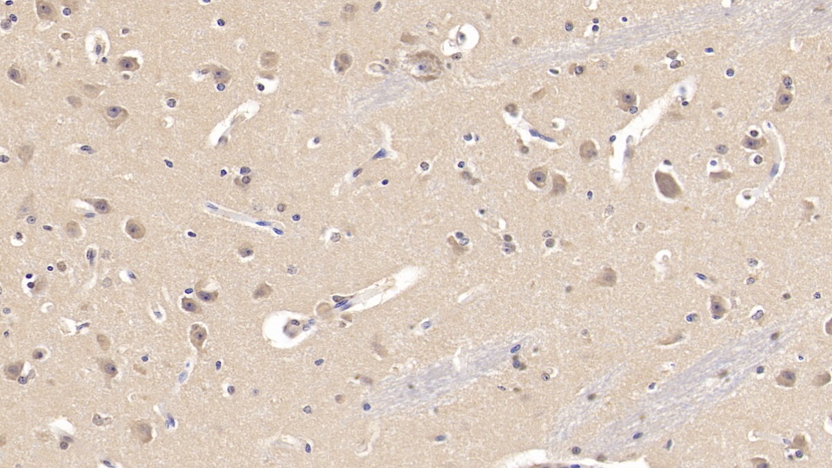 Monoclonal Antibody to Semaphorin 3A (SEMA3A)