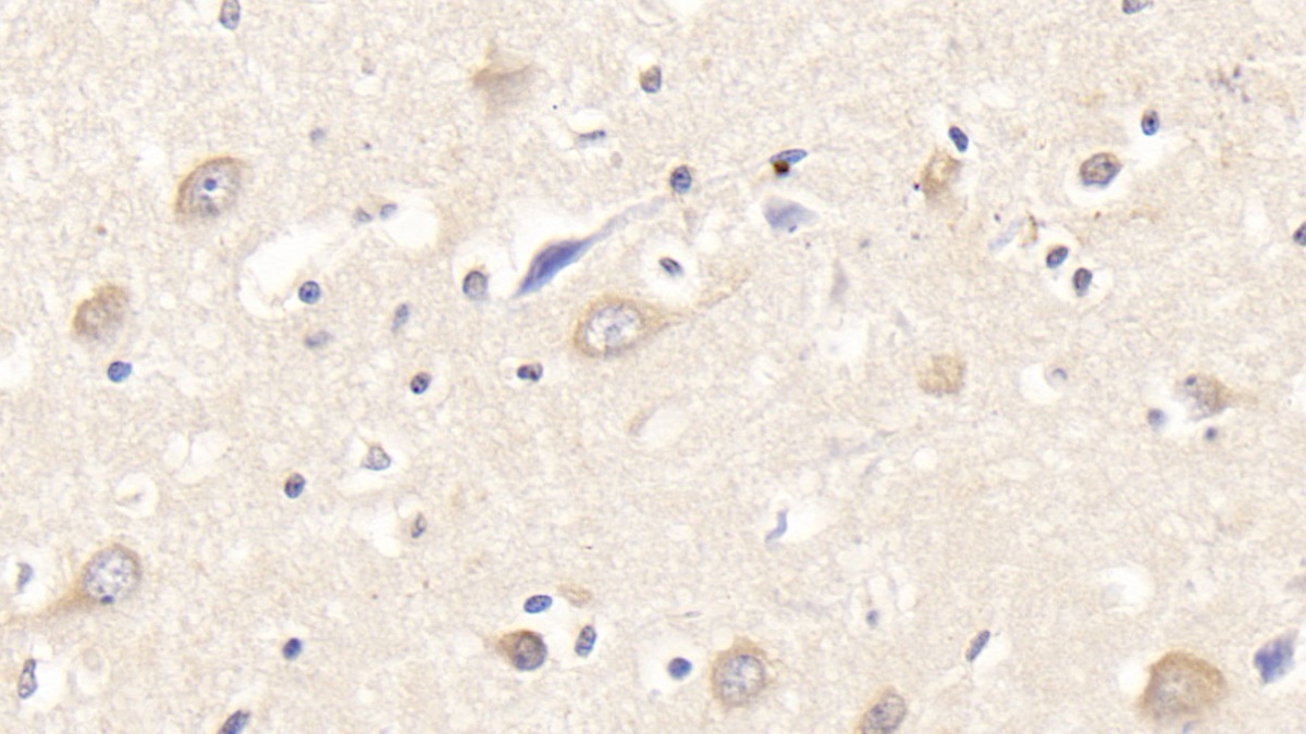 Monoclonal Antibody to Semaphorin 3A (SEMA3A)