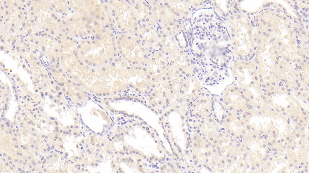 Monoclonal Antibody to Semaphorin 3A (SEMA3A)