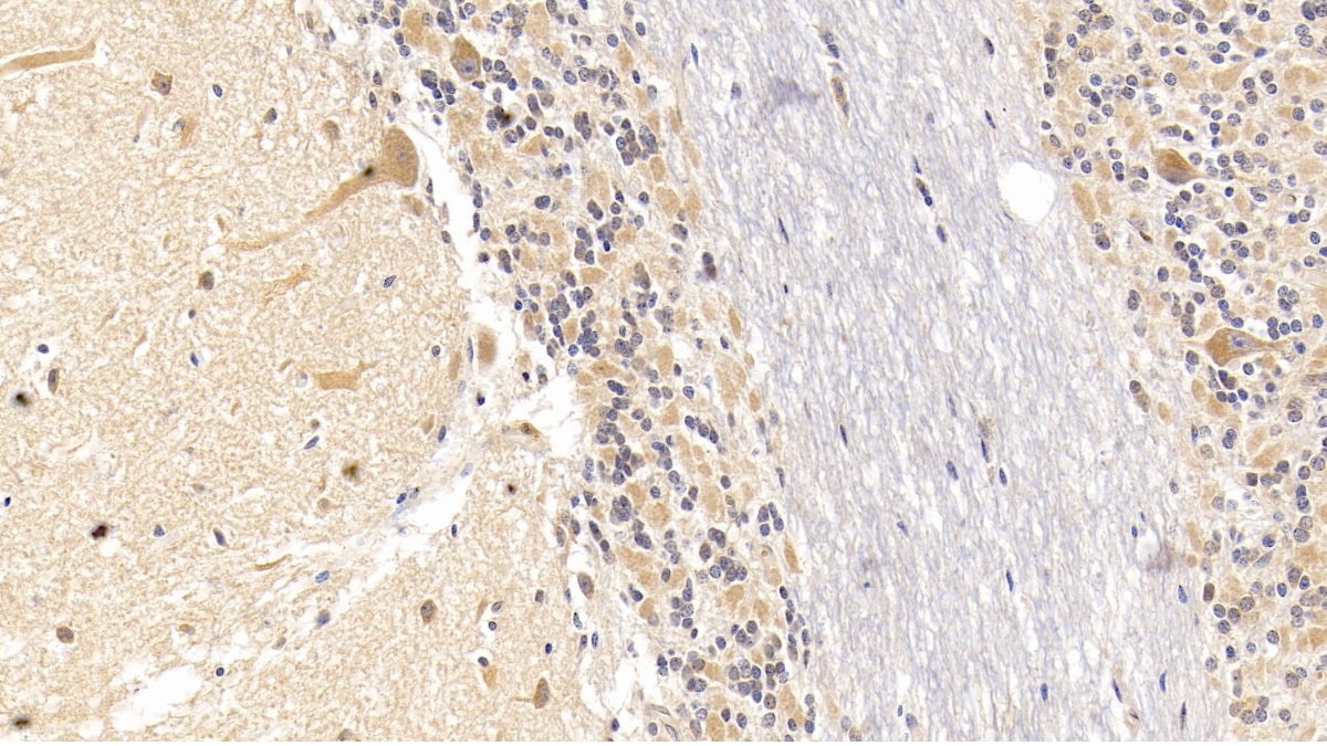 Monoclonal Antibody to Semaphorin 5B (SEMA5B)