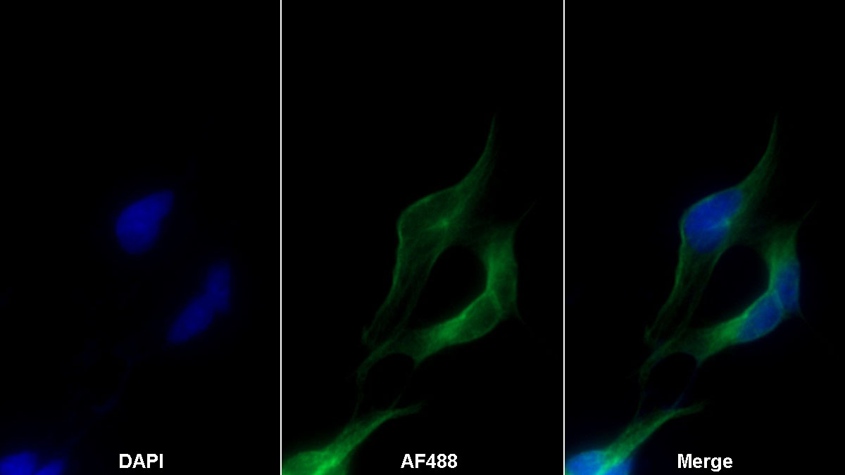 Monoclonal Antibody to Semaphorin 5B (SEMA5B)