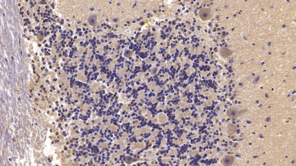 Monoclonal Antibody to Semaphorin 5B (SEMA5B)