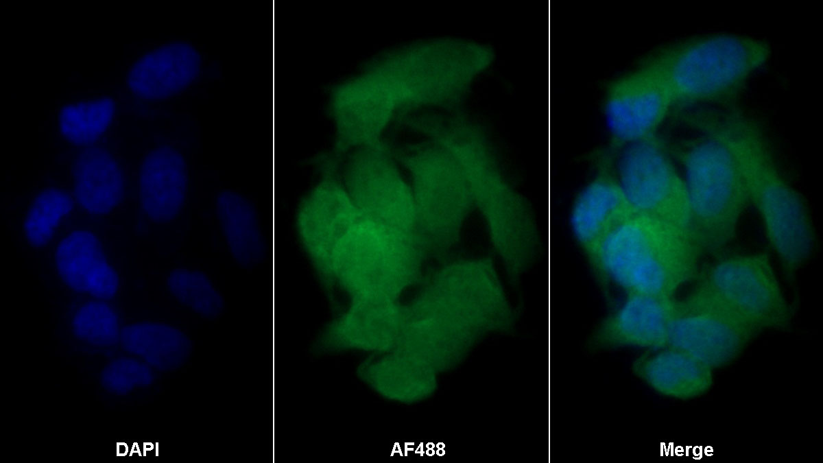 Monoclonal Antibody to Semaphorin 5B (SEMA5B)