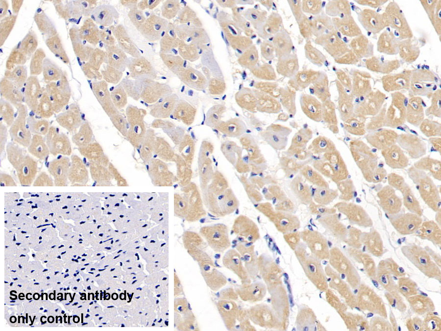 Monoclonal Antibody to Semaphorin 5B (SEMA5B)