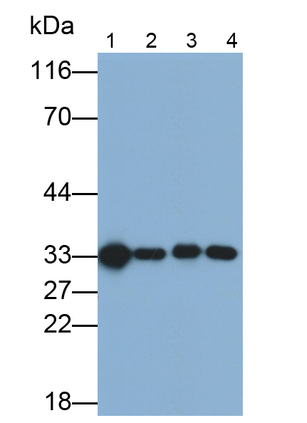 Monoclonal Antibody to NADH Dehydrogenase, Quinone 1 (NQO1)