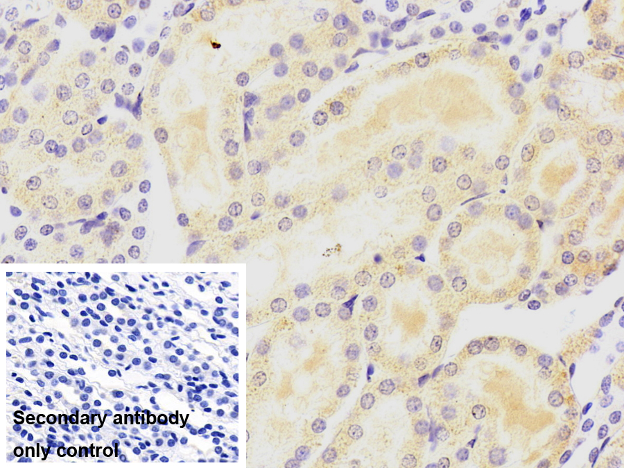 Monoclonal Antibody to NADH Dehydrogenase, Quinone 1 (NQO1)
