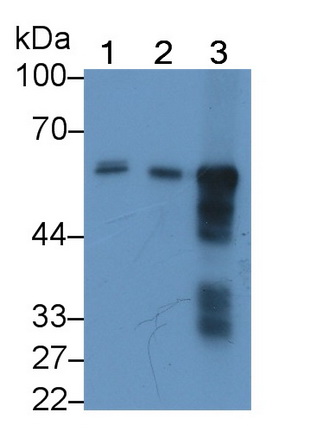 Monoclonal Antibody to Amylase Alpha 2B, Pancreatic (AMY2B)