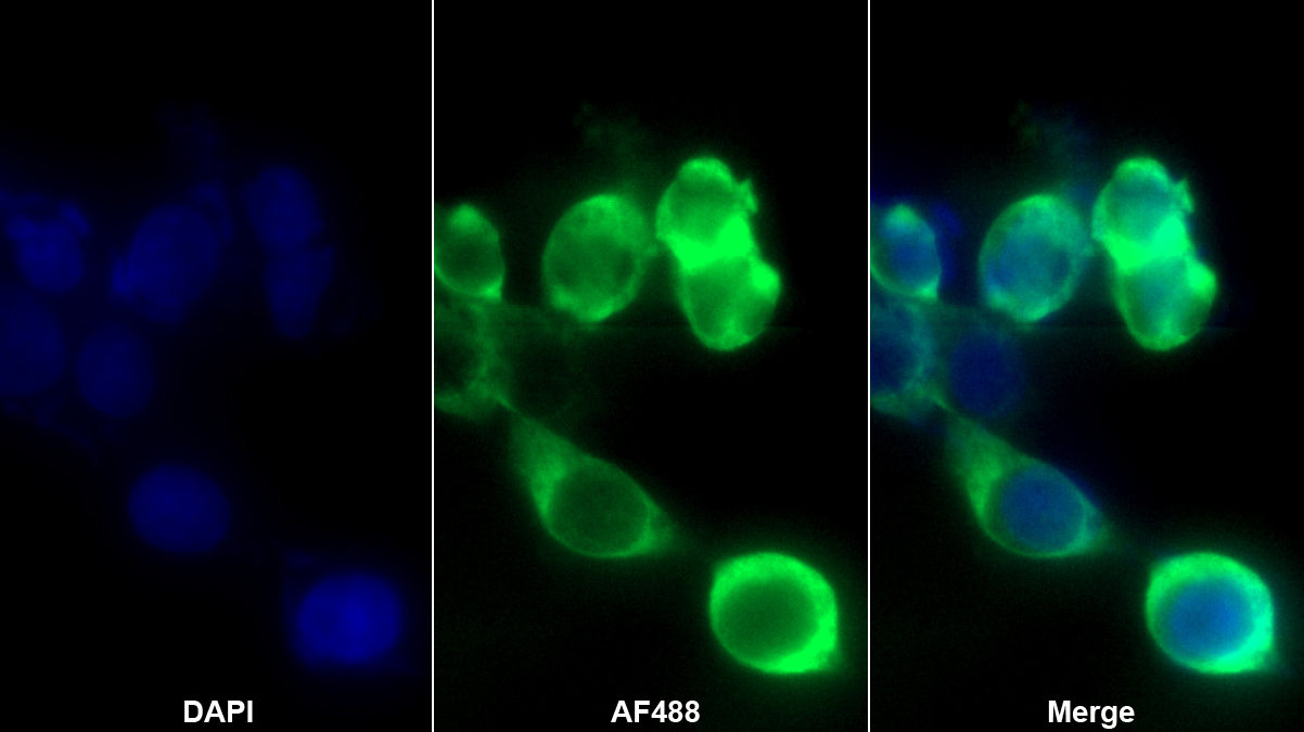 Monoclonal Antibody to Complement Component 4d (C4d)