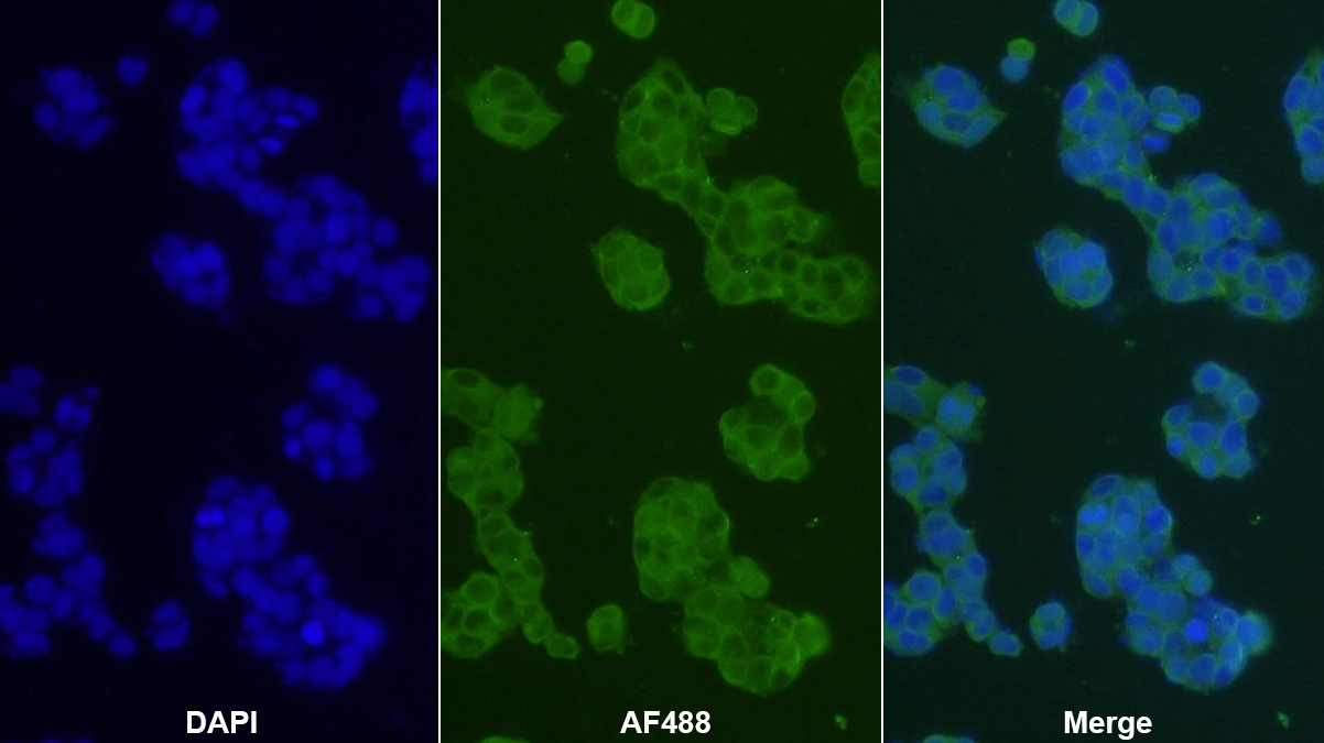 Monoclonal Antibody to Complement Component 3c (C3c)