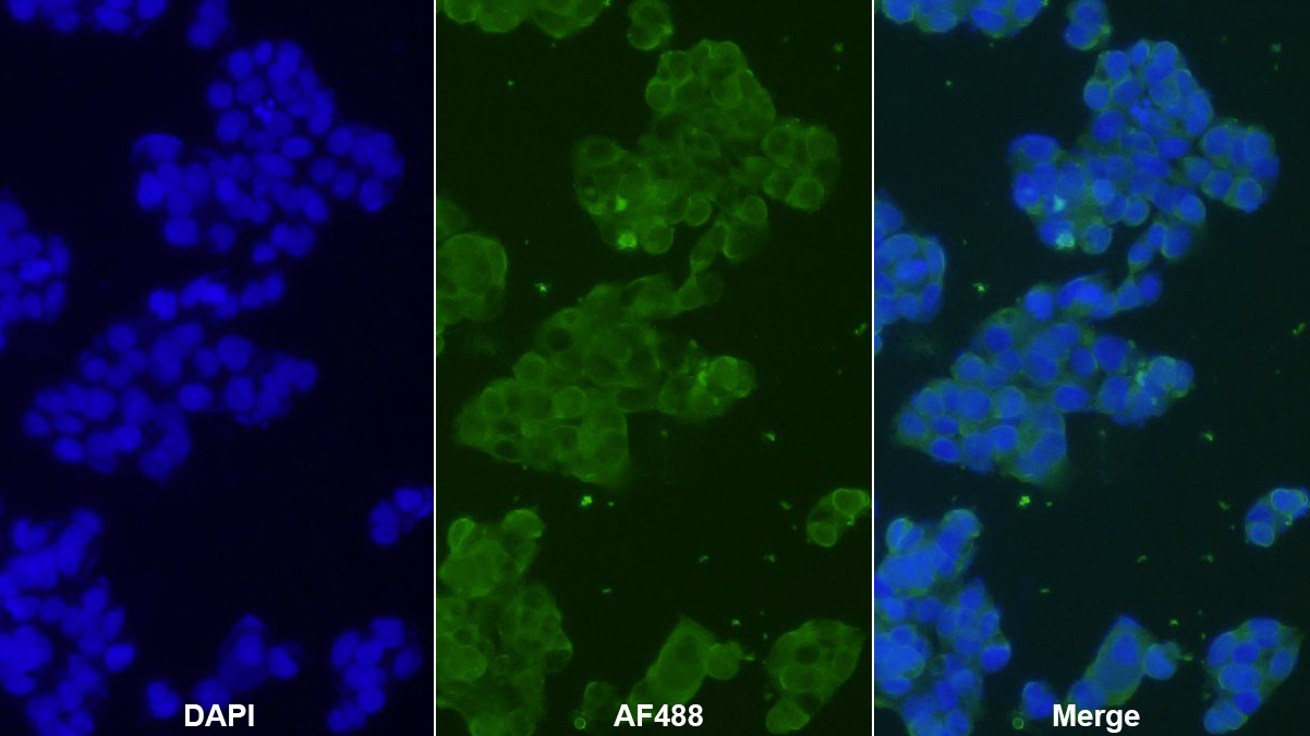 Monoclonal Antibody to Complement Component 3c (C3c)