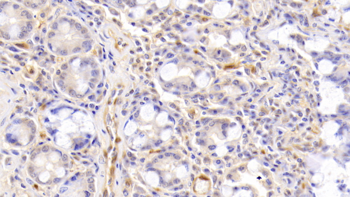 Polyclonal Antibody to Activin A (ACVA)