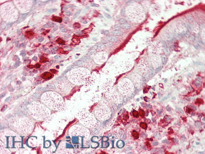 Polyclonal Antibody to Angiotensin I Converting Enzyme (ACE)