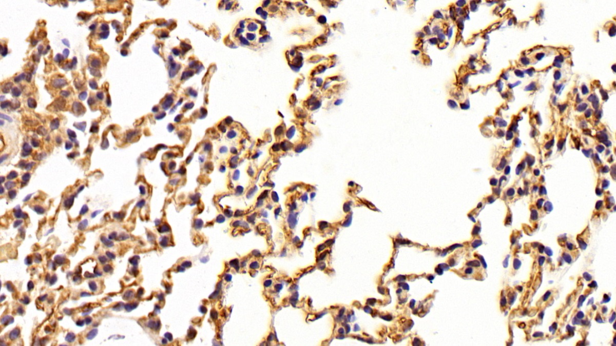 Polyclonal Antibody to Angiotensin I Converting Enzyme (ACE)