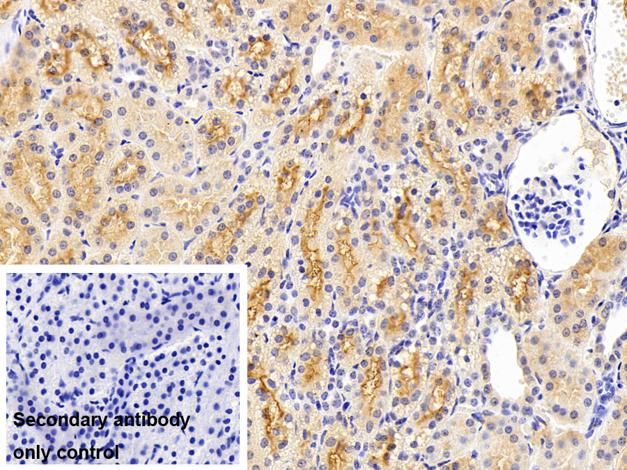 Polyclonal Antibody to Angiotensin I Converting Enzyme (ACE)