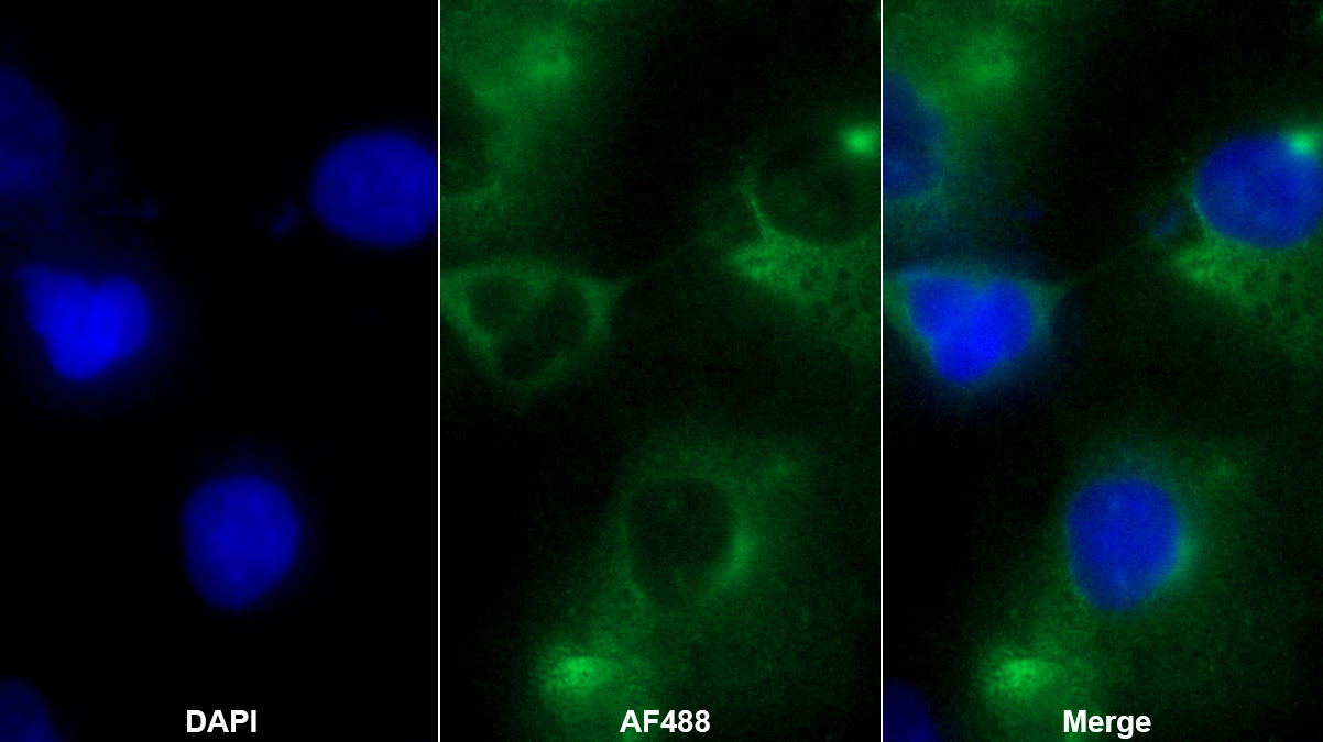 Polyclonal Antibody to Angiopoietin 2 (ANGPT2)
