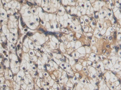 Polyclonal Antibody to Connective Tissue Growth Factor (CTGF)