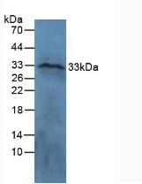 Polyclonal Antibody to Connective Tissue Growth Factor (CTGF)