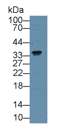 Polyclonal Antibody to Connective Tissue Growth Factor (CTGF)