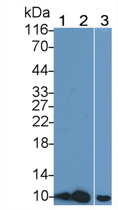 Polyclonal Antibody to S100 Calcium Binding Protein (S100)